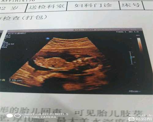 泰国代孕有假的吗：另类胎教方法：代孕期同房