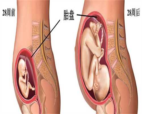 泰国代孕移植一个月怎么办_泰国代孕的小孩聪明吗