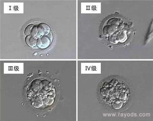 武汉正规代生_武汉代生产子价格是多少_试管胚胎等级分类，二级胚胎是不是优