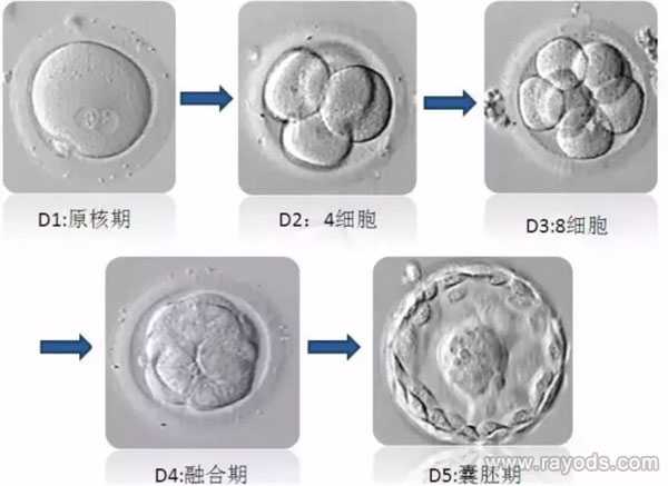 武汉正规代生_武汉代生产子价格是多少_试管胚胎等级分类，二级胚胎是不是优