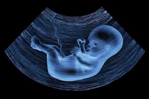 不孕不育的电话_助孕咨询坤和助孕_胎动在腰上是什么胎位